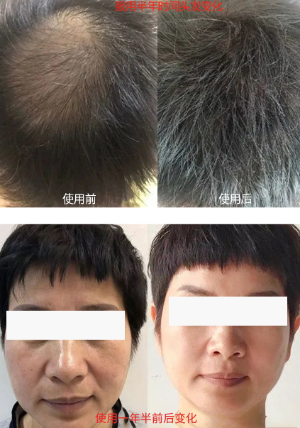 使用效果圖